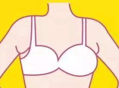 副乳可以去除吗？怎样预防副乳的出现？