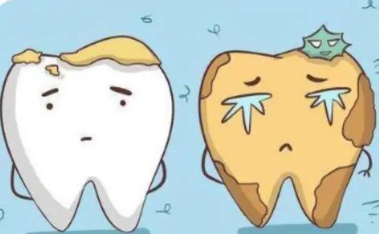 洗牙齿可以去除口臭吗