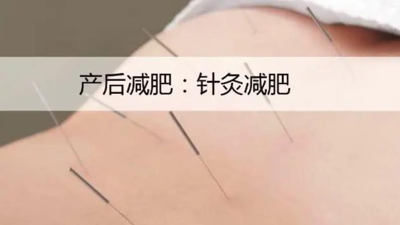 上海针灸减肥价目表最新