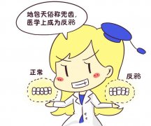 地包天矫正需要多少钱？3大价格影响因素盘点+手术注意事项